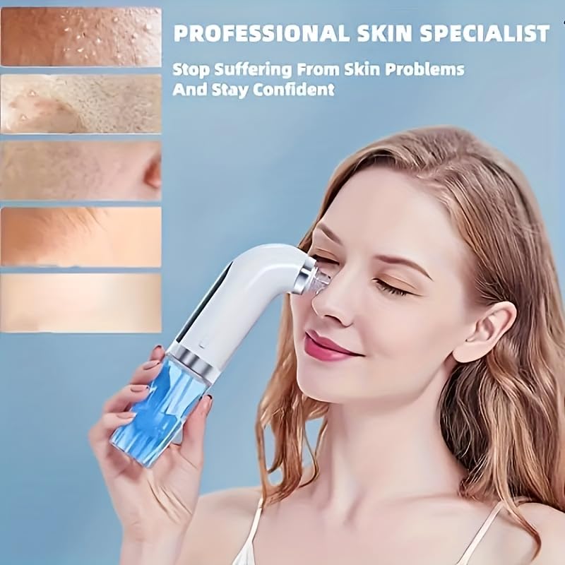 Pore Vacuum - Removedor de espinillas, aspirador de poros,