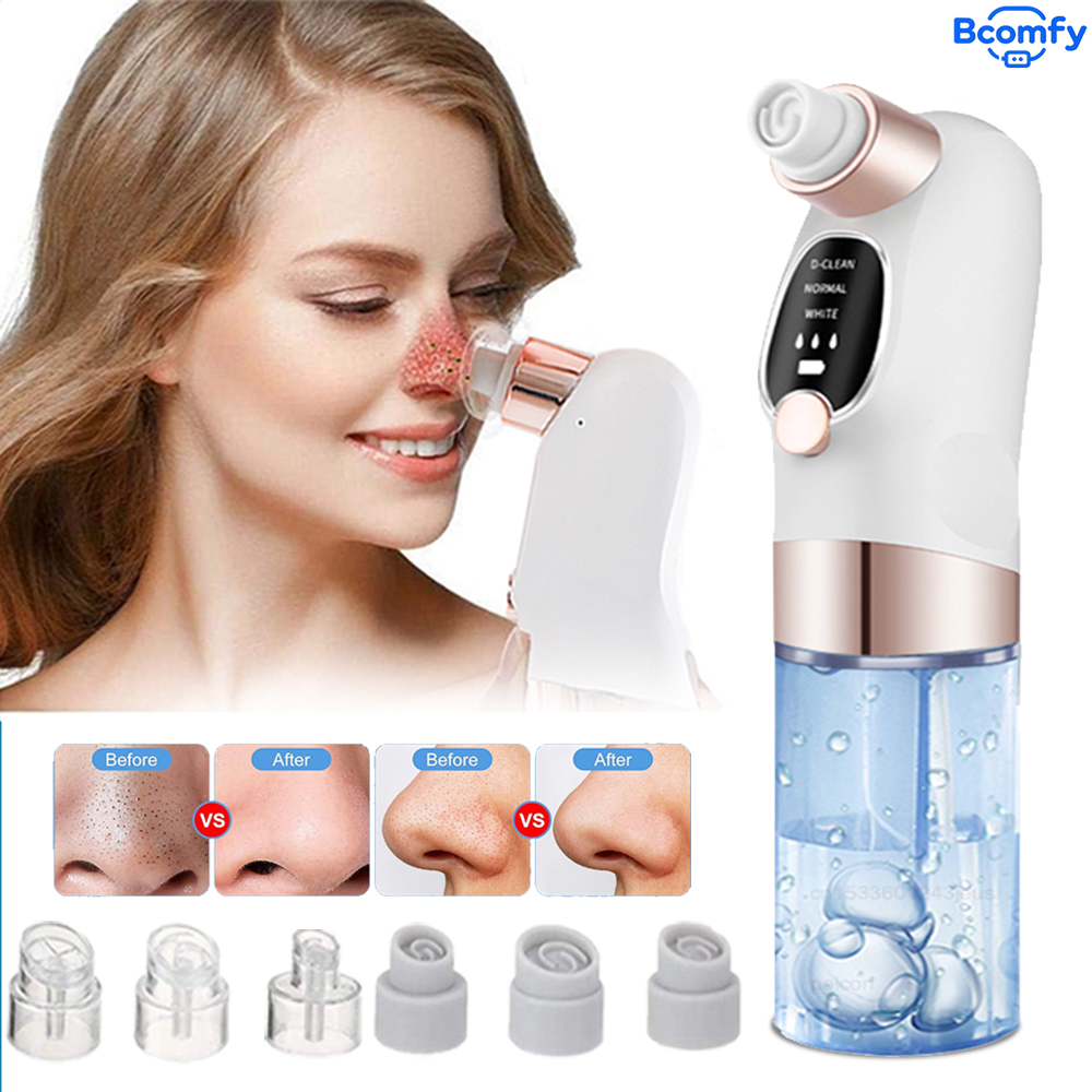 Pore Vacuum - Removedor eléctrico de espinillas, limpiador de