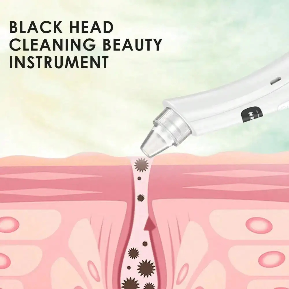 Herramienta Facial de Vacío de - Pore Vacuum reseña y precio