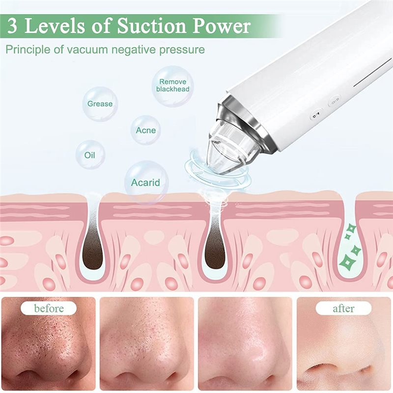 【ACCADO】Kit de vacío de poros  - Pore Vacuum reseña y precio