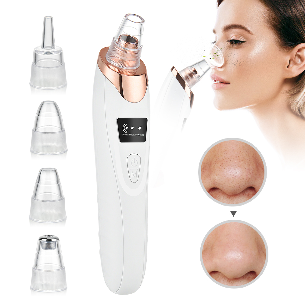 Removedor de espinillas de suc - Pore Vacuum reseña y precio