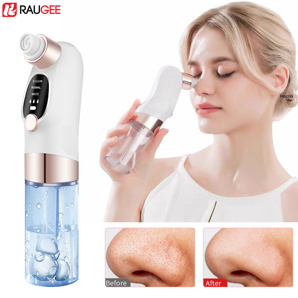 Extractor de espinillas eléctr - Pore Vacuum reseña y precio