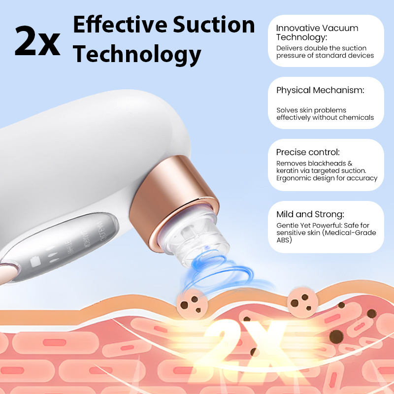 Aspirador Eléctrico de Poros,  - Pore Vacuum reseña y precio