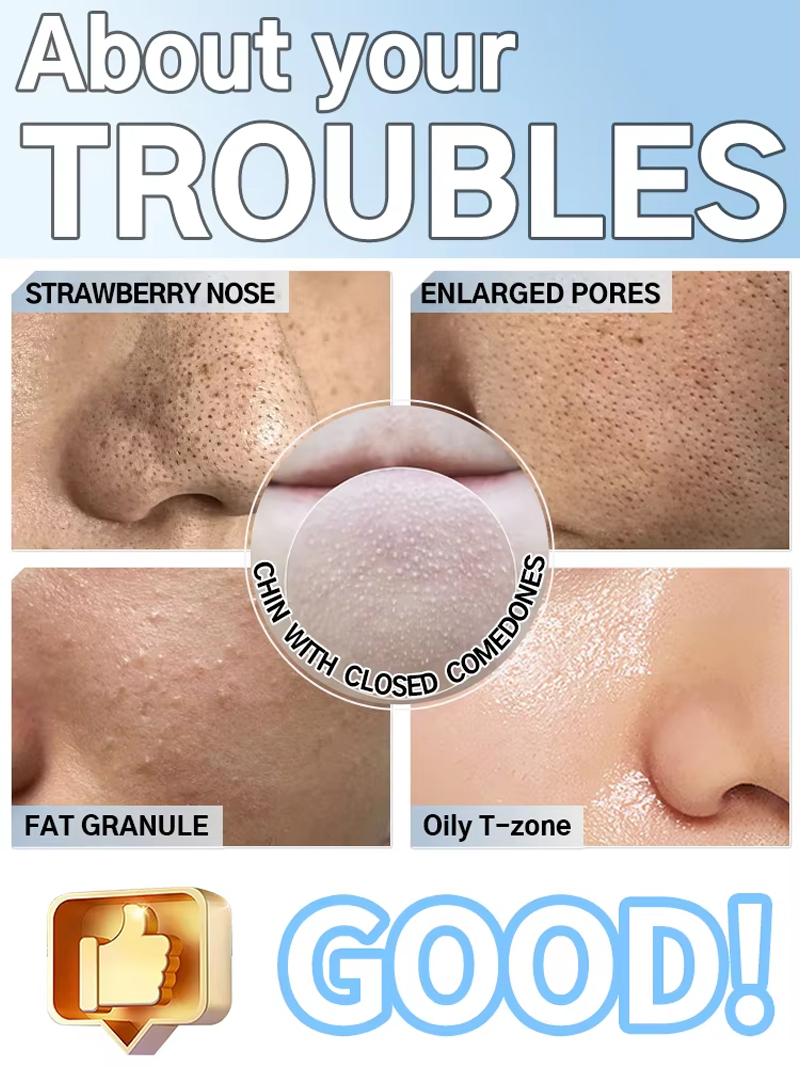 Removedor de puntos negros, li - Pore Vacuum reseña y precio