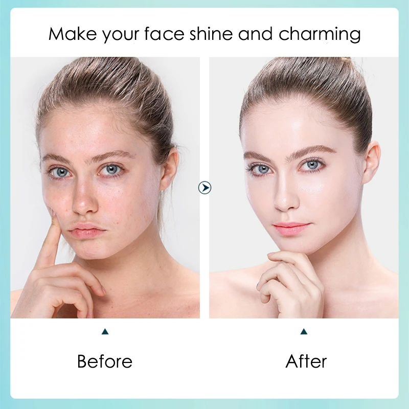 10 Uds. Mascarilla Facial hidr - Sheet Face Mask Pack reseña y precio